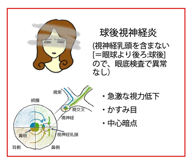 第59回理学療法士国家試験 午前31-35の解説|Sixty_valleyのページ