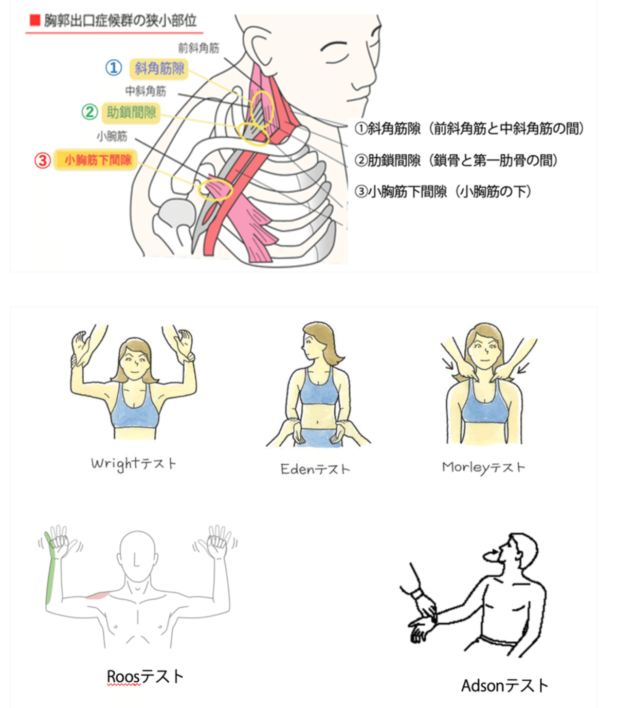 第59回理学療法士国家試験 午前31-35の解説｜Sixty_valleyのページ