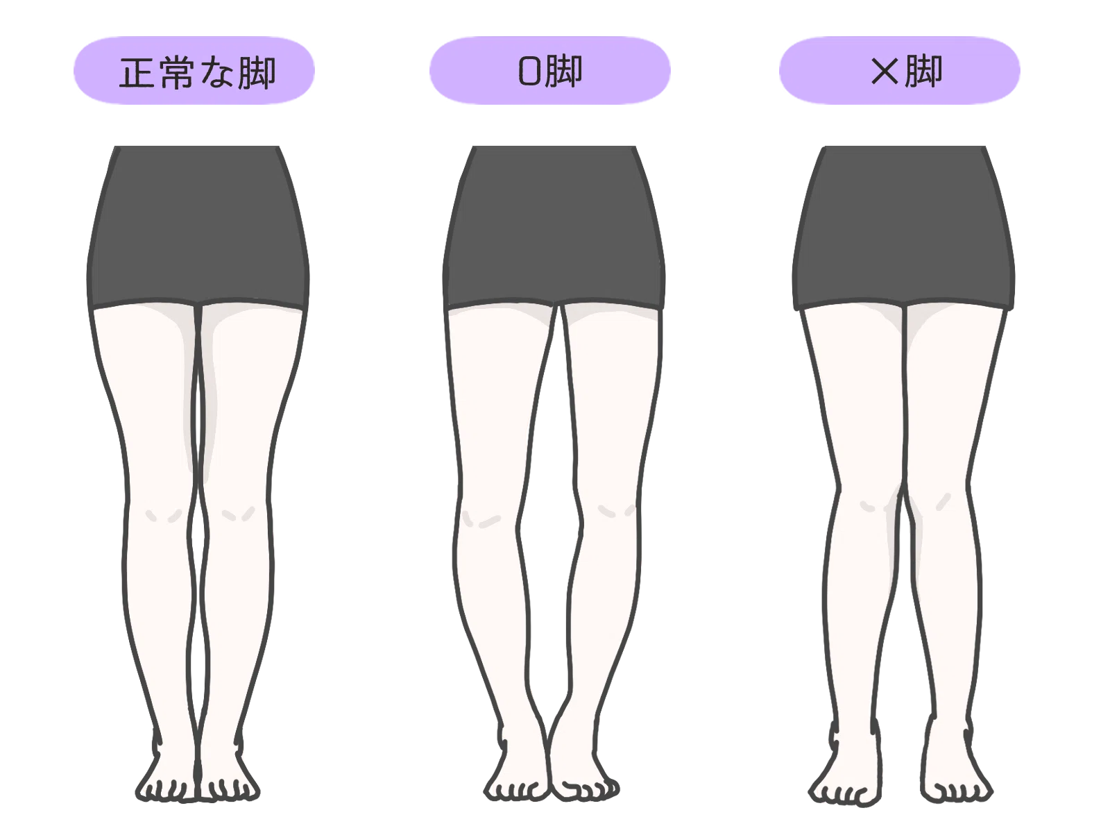 O脚のついて丁寧に解説。「O脚とは?」「なぜ悪いの?」や改善方法について。|東京都港区南青山の骨 | Skeletal Adjustment ...