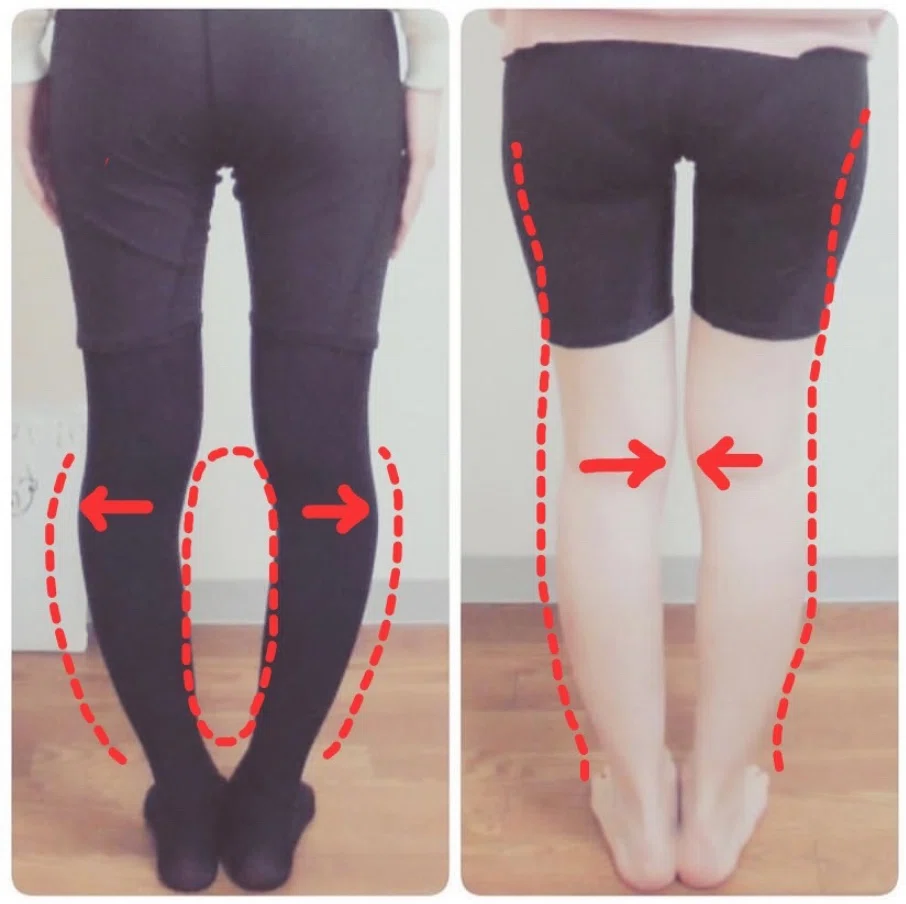 O脚 骨盤からくる _ 骨盤の左右差をなくしたい|腰をひねったり回す運動で歪み解消 – MVMEPY