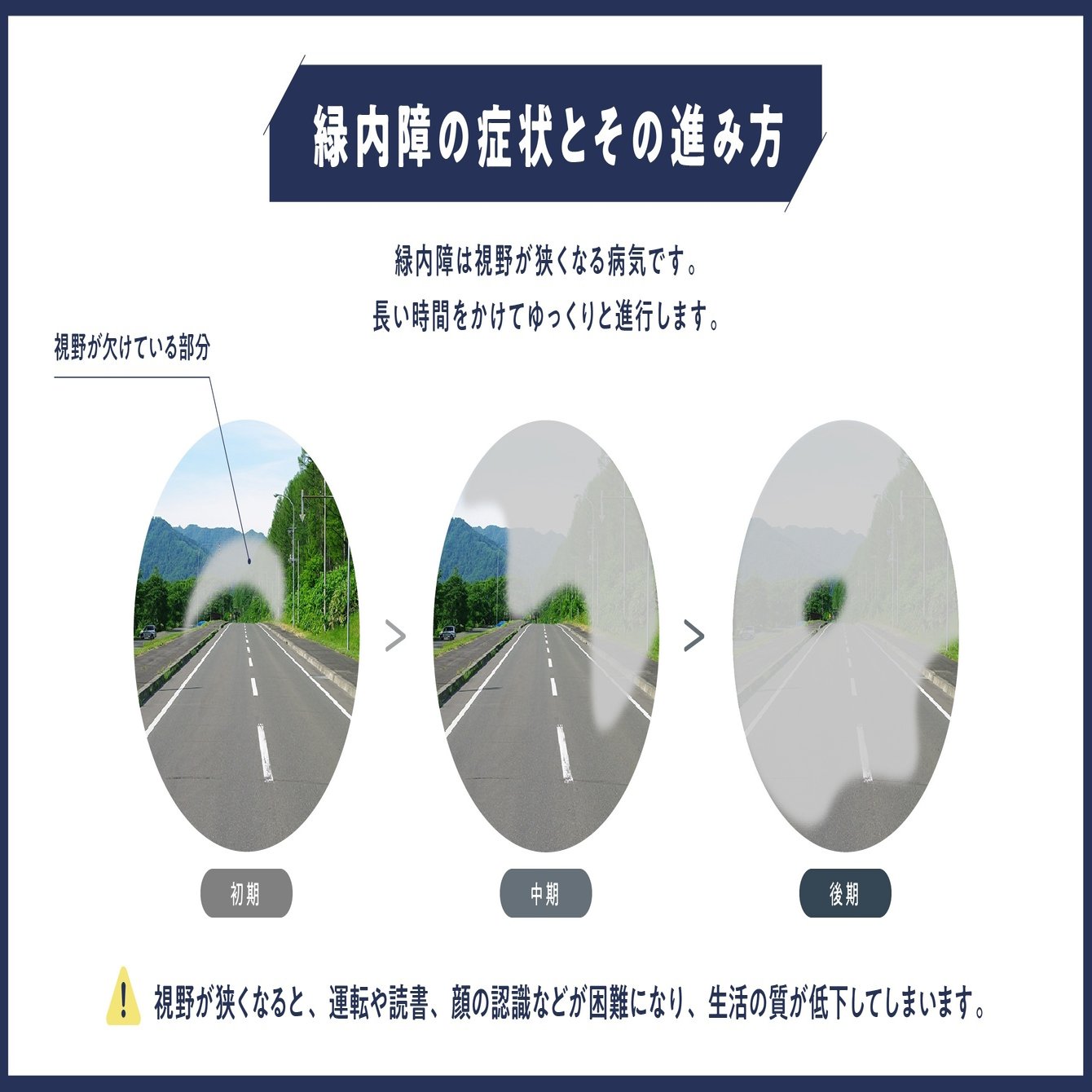 緑内障に「関係ない」はない！あなたにこそ気づいてほしい、「緑内障」の足音 part2｜東北大学COI-NEXT「Vision to Connect」