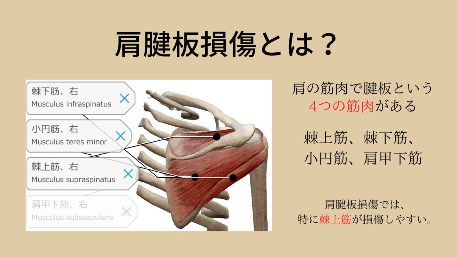 腱板損傷とは何か