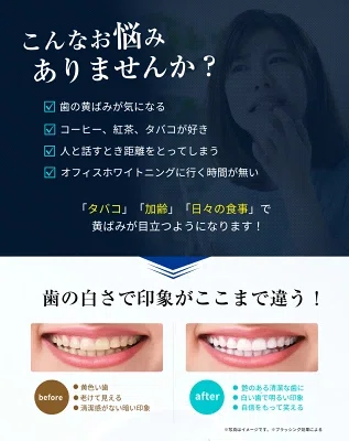 驚きの白さ！TVで話題沸騰中の3D Smileホワイトニングシートが 