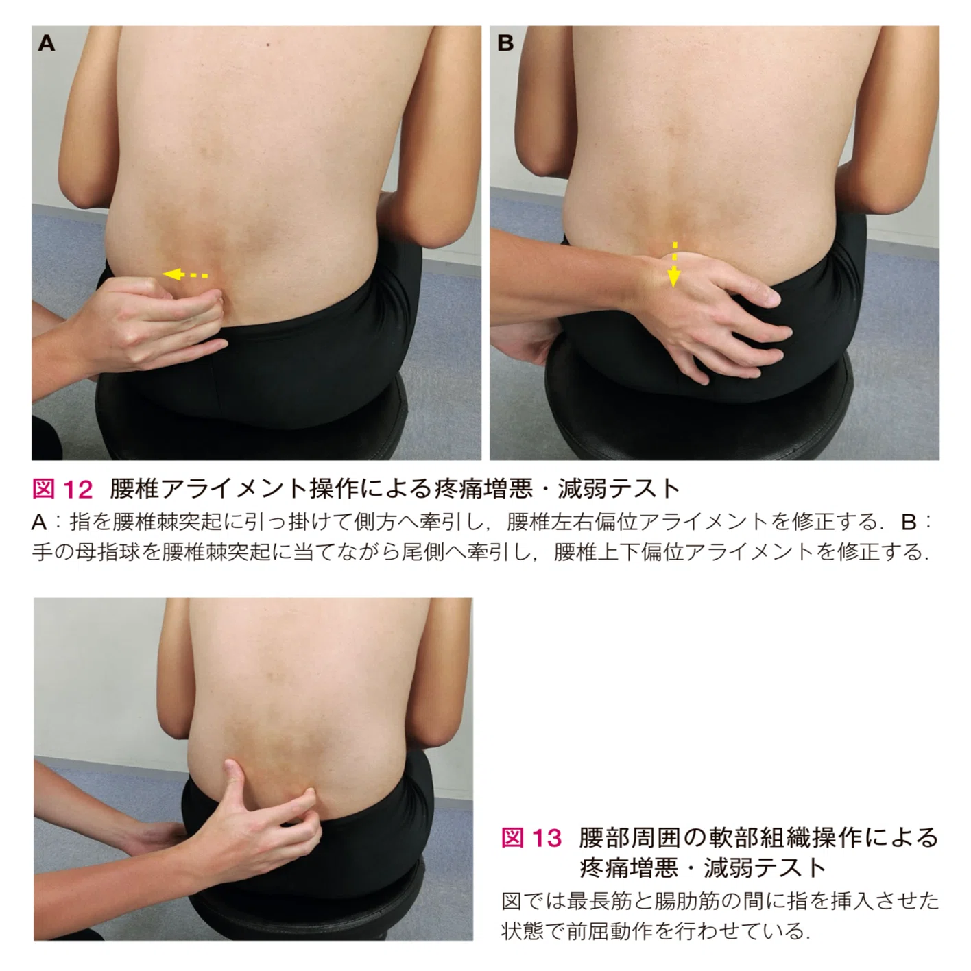図説腰椎の臨床 胸椎、腰椎の機能解剖【整形外科学ブログ】