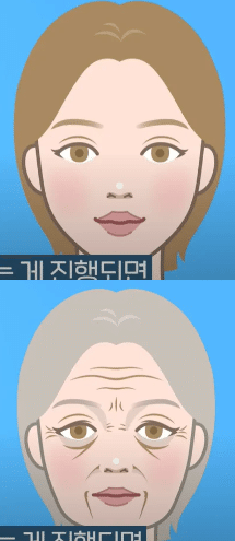 韓国整形　韓国美容外科　小鼻　鼻整形　プロテーゼ　鷲鼻　アップノーズ