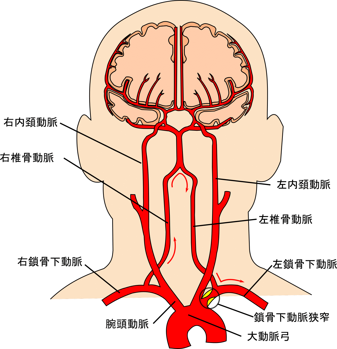 脳血管 ＃2-4 大動脈弓部｜脳卒中リハビリテーション看護認定看護師の