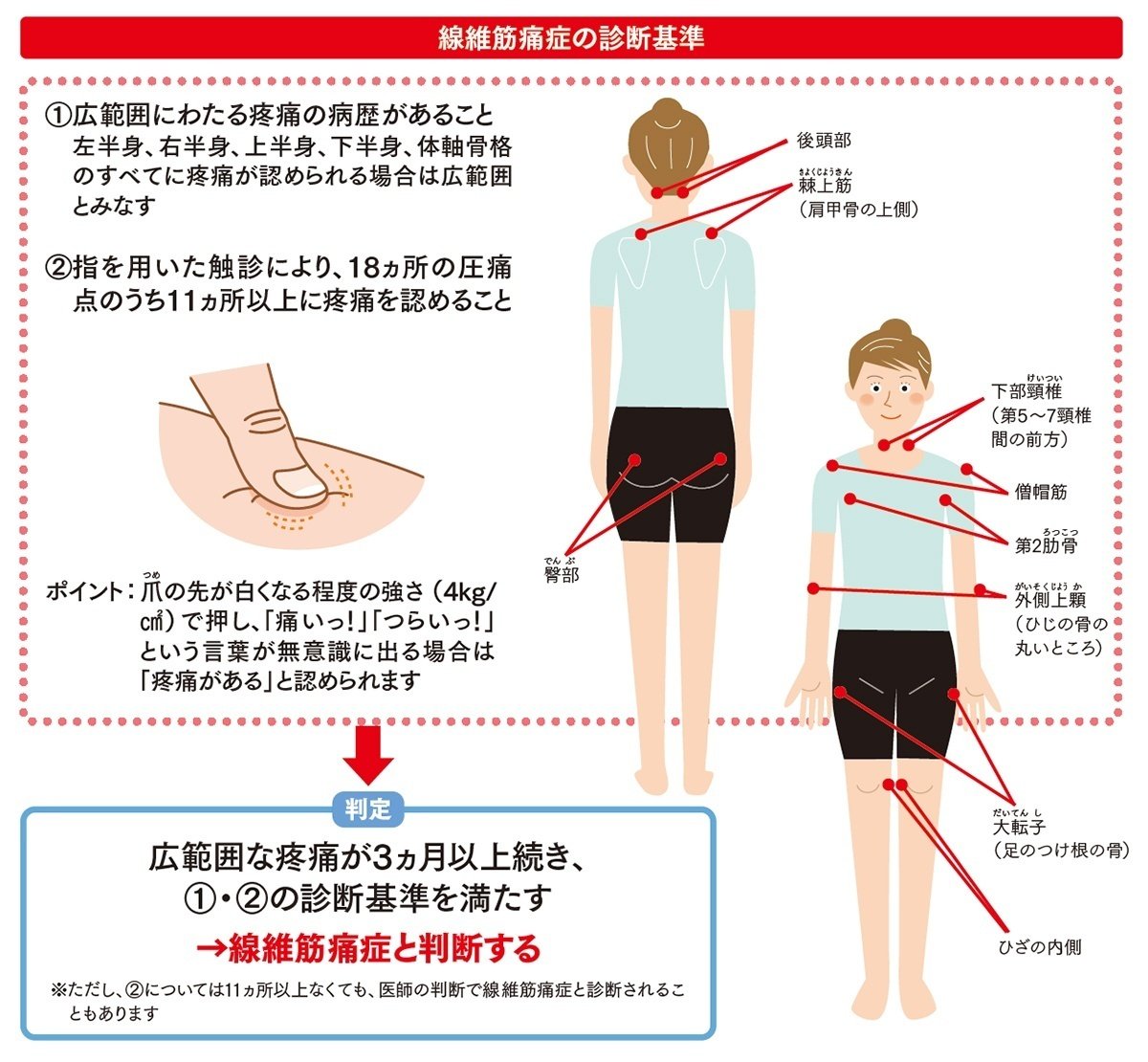 RIAN線維筋痛症ページ 原因不明といわれつづけた激痛の原因が判明！あなたの痛みが線維筋痛症