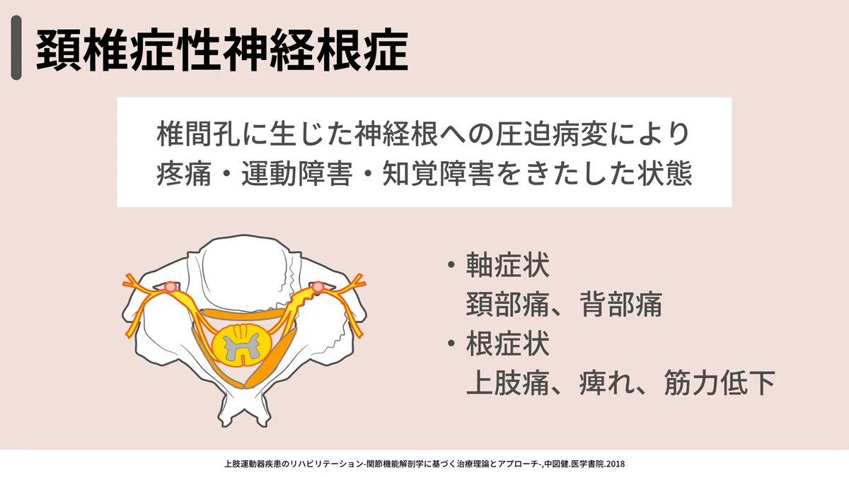 上肢の絞扼性神経障害の治療戦略｜小林龍樹＠理学療法士