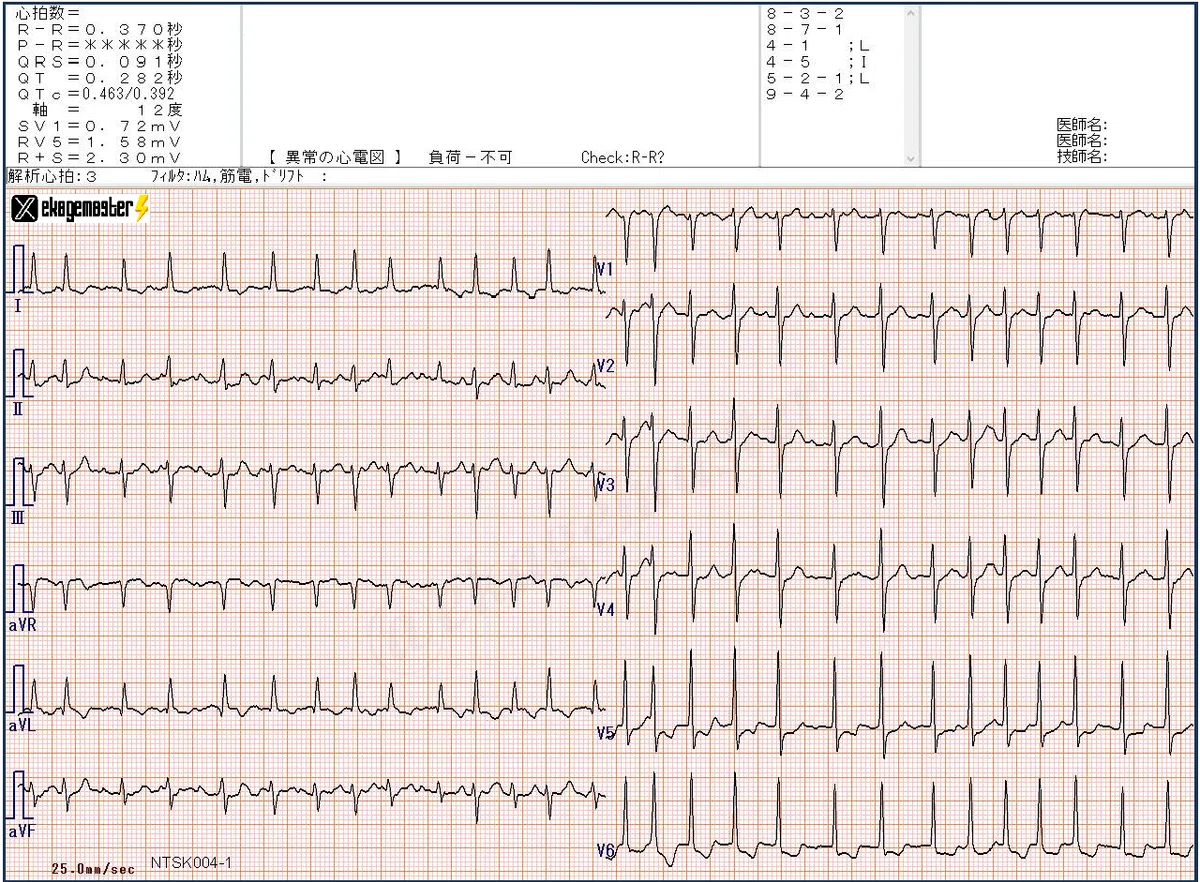 ECG Certification Preparation Course [Question 4]｜えかげますたぁ｜Dr.ヒロ