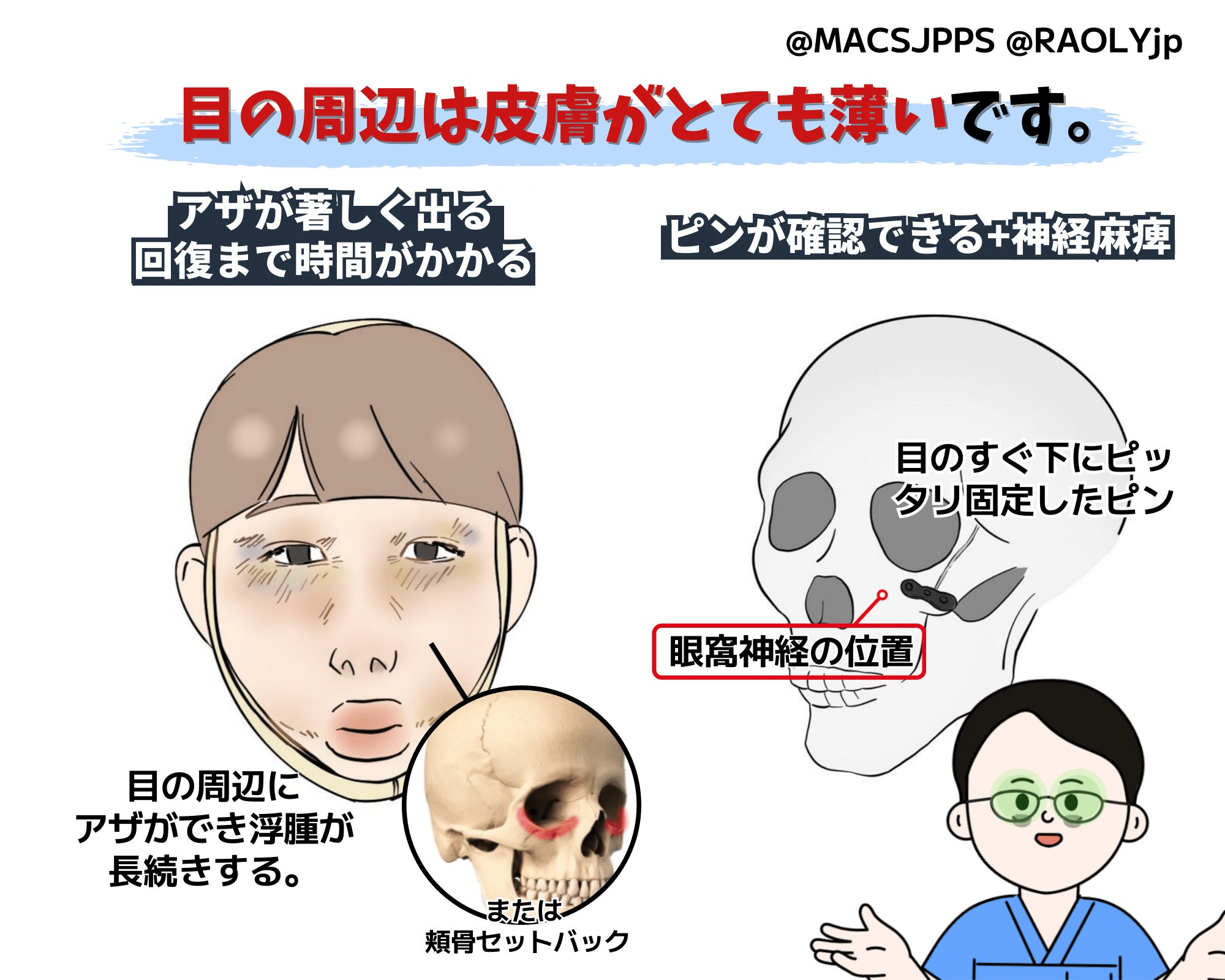 顔面骨への手術アプローチ　【裁断済み】 顔面骨への手術アプローチ【裁断済み】