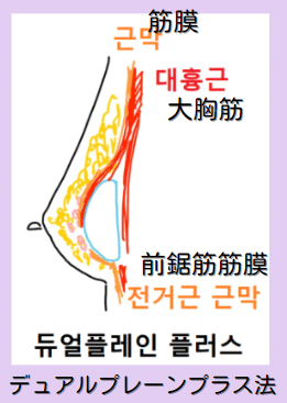韓国整形 豊胸 谷間 バストアップ 垂れ乳