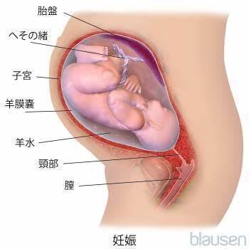 妊婦の腹部のの断面画像