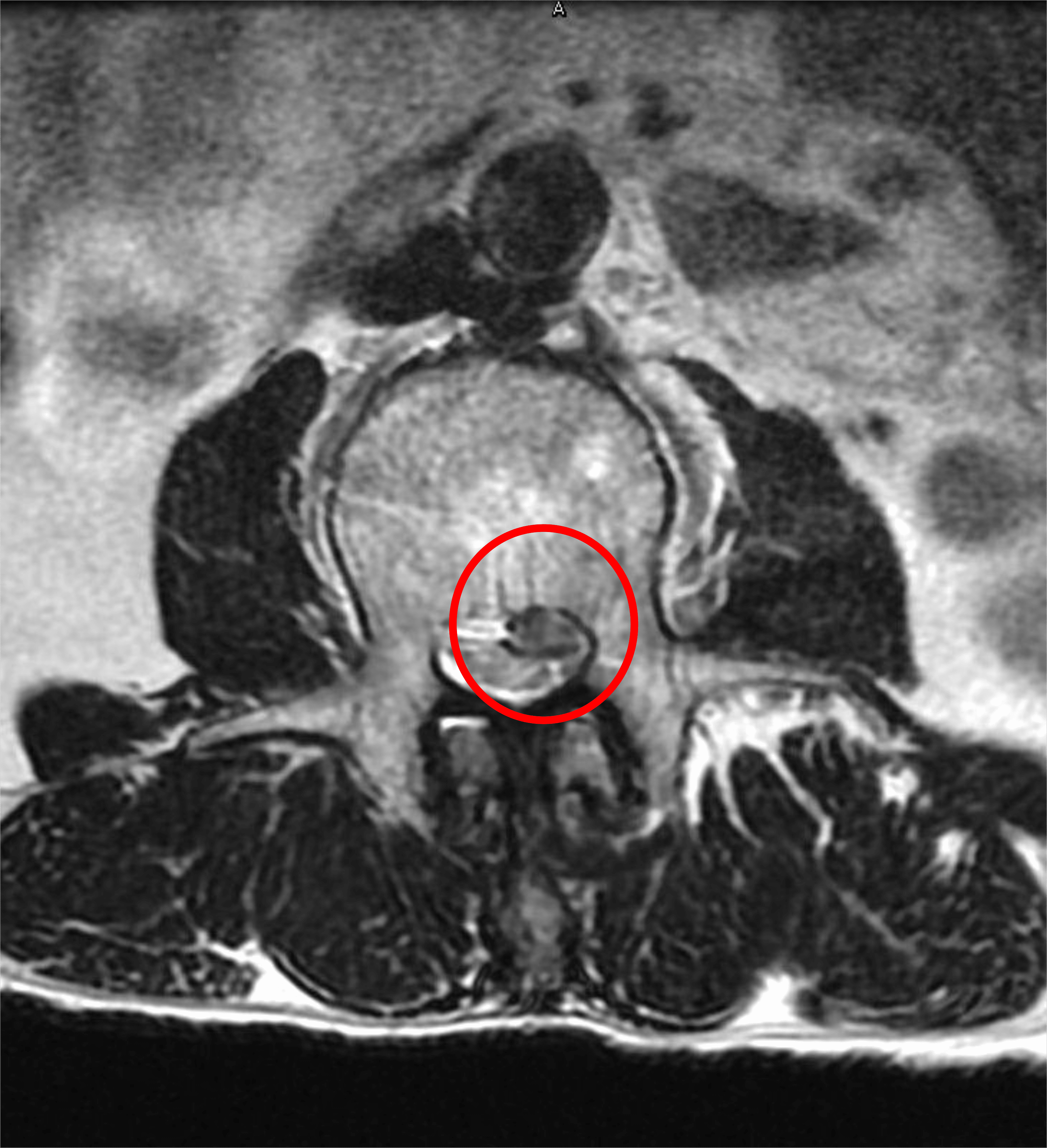 裁断済 三輪書店 エキスパートのための脊椎脊髄疾患のMRI エキスパート