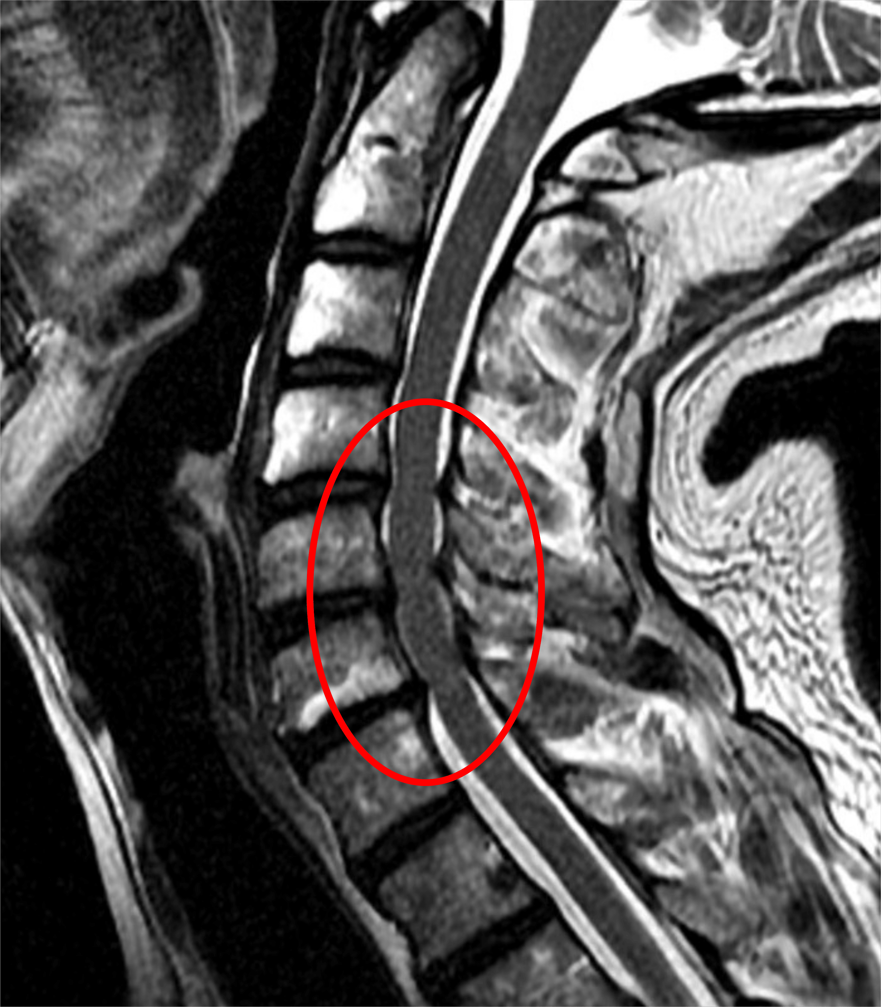 裁断済】エキスパートのための脊椎脊髄疾患のMRI = MRI of … 商品詳細