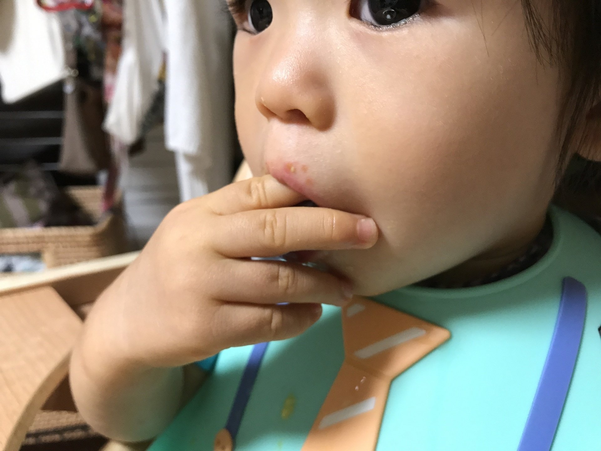 果物を食べたら口がかゆくなりました。アレルギーですか？」 ｜☆近大