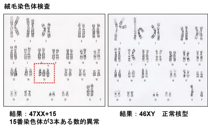 確認用 不育症治療をしても流産してしまったら｜medicalgram【メジカルビュー