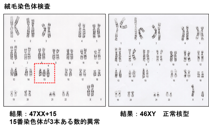 ままちゃん様ご確認用 シンママ様ご確認 お箸×3 （息子が喜ぶ神レシピ！簡単親子丼の