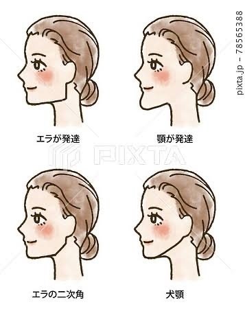 エラ張 エラを削らなくても ここまで輪郭は変わります。 顔だけじゃなく “全身