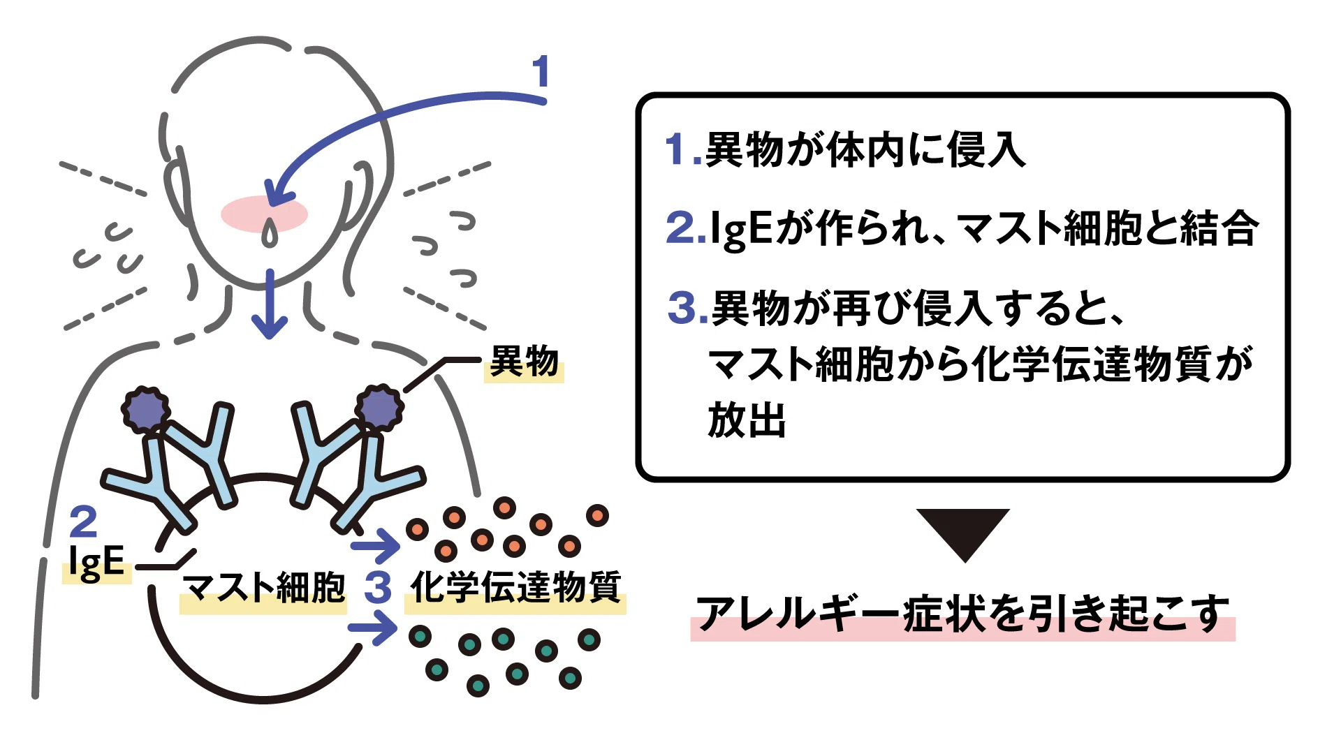 こう治す　複合汚染アレルギー アレルギーの発症メカニズム解明が、治療薬開発のカギ！？｜金城学院