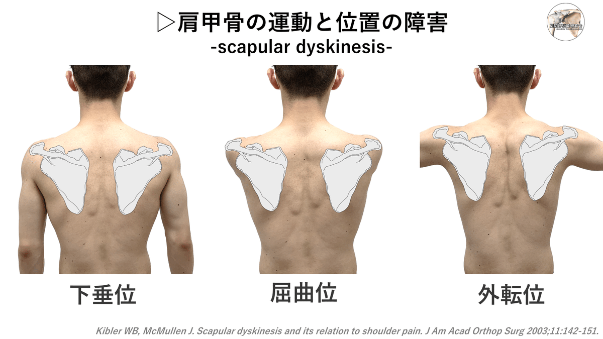全身運動からみる肩関節の評価～肩関節疾患のメカニズムと評価アプローチの実際～ 全身運動からみる肩関節の評価 ～肩関節疾患のメカニズムと評価