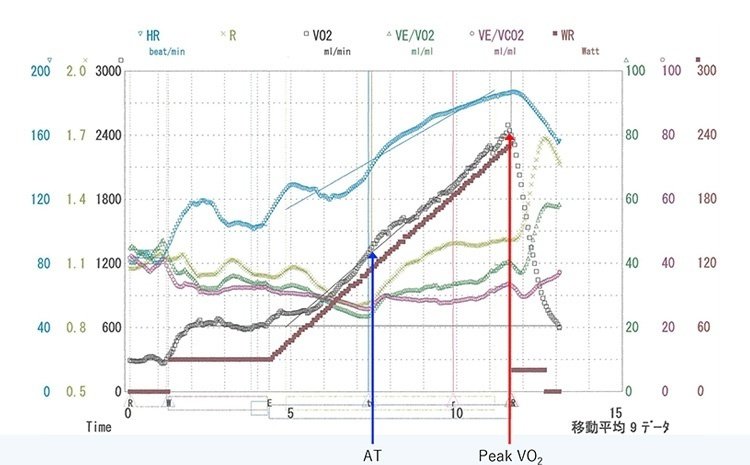 Amazon.co.jp: 今日から始めよう!運動負荷試験 : 上嶋健治: 本