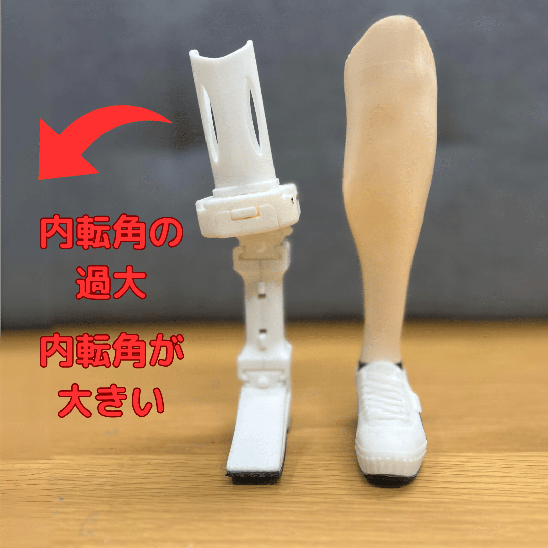 下腿義足：内側方向の不安定感1｜GAIT ASSIST
