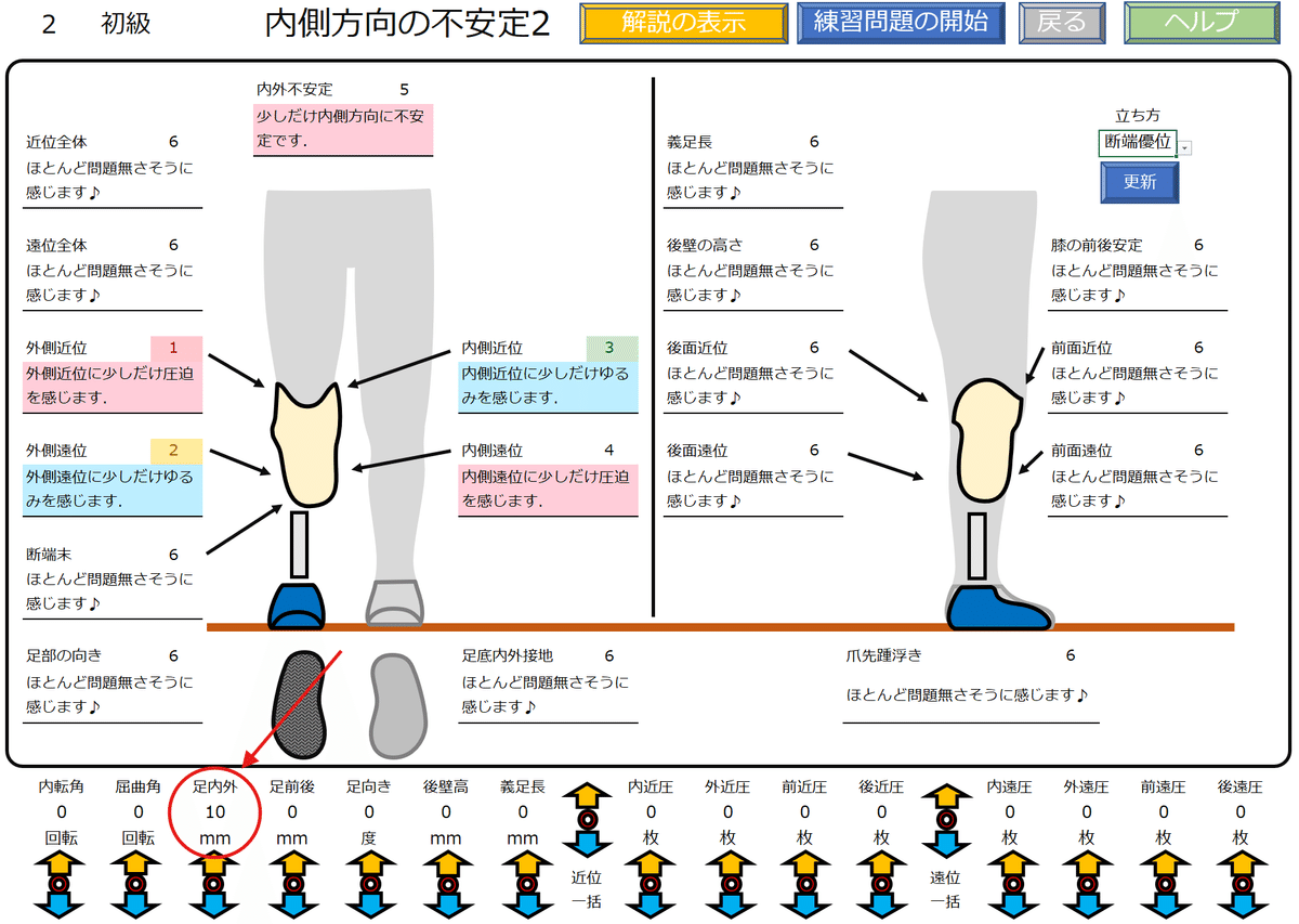 右膝下義足 下腿義足：内側方向の不安定感2｜GAIT ASSIST