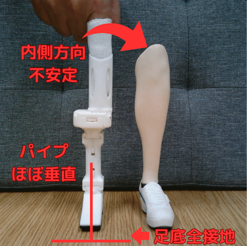 下腿義足：内側方向の不安定感2｜GAIT ASSIST