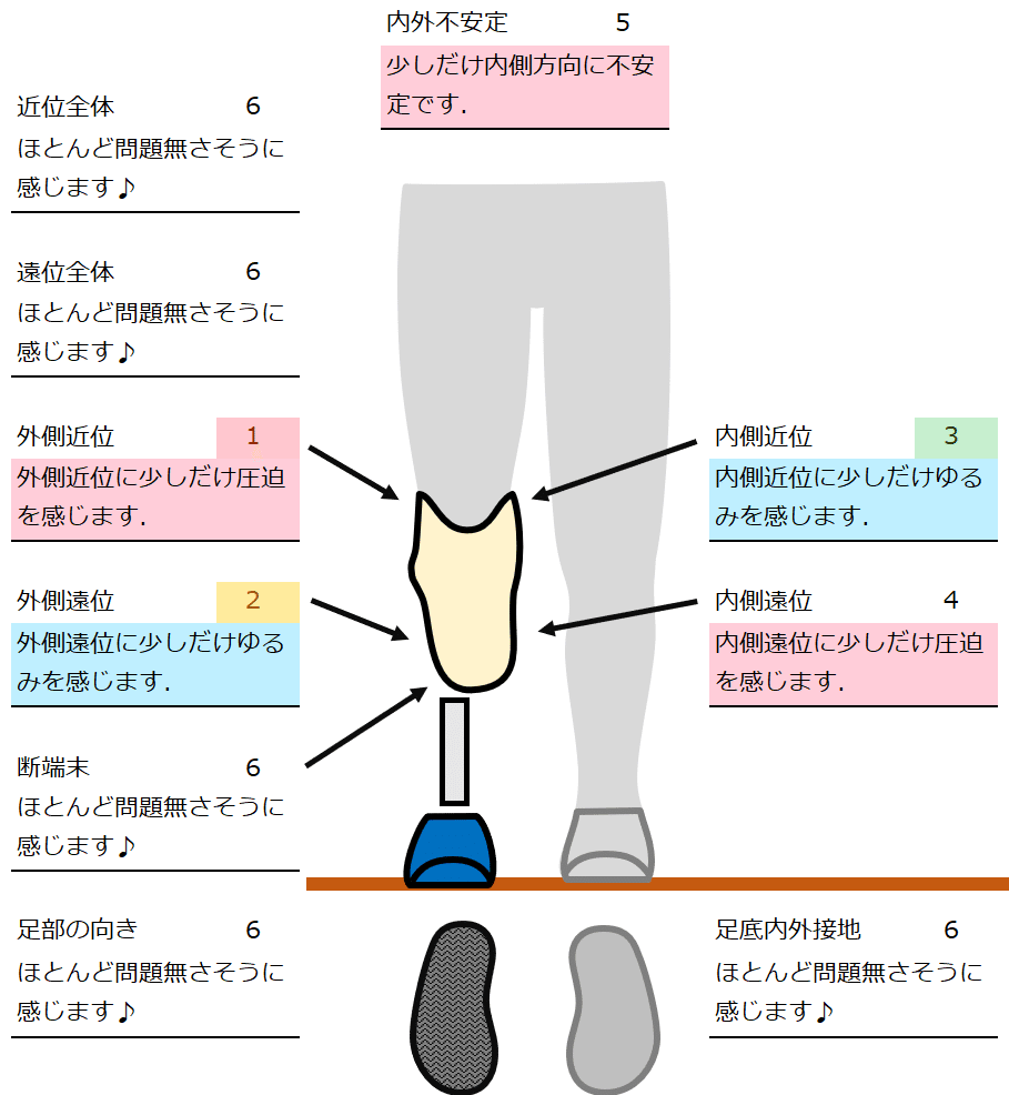 下腿義足：内側方向の不安定感2｜GAIT ASSIST