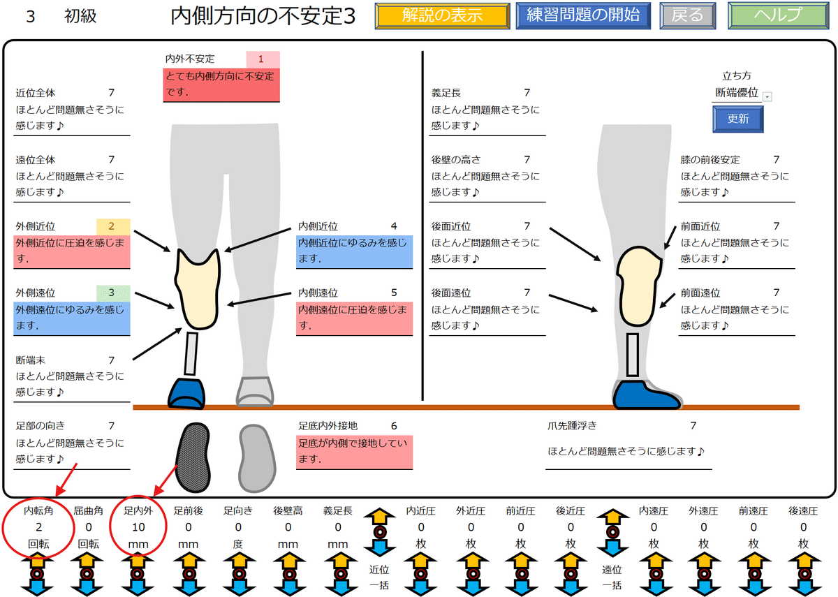 下腿義足：内側方向の不安定感3｜GAIT ASSIST