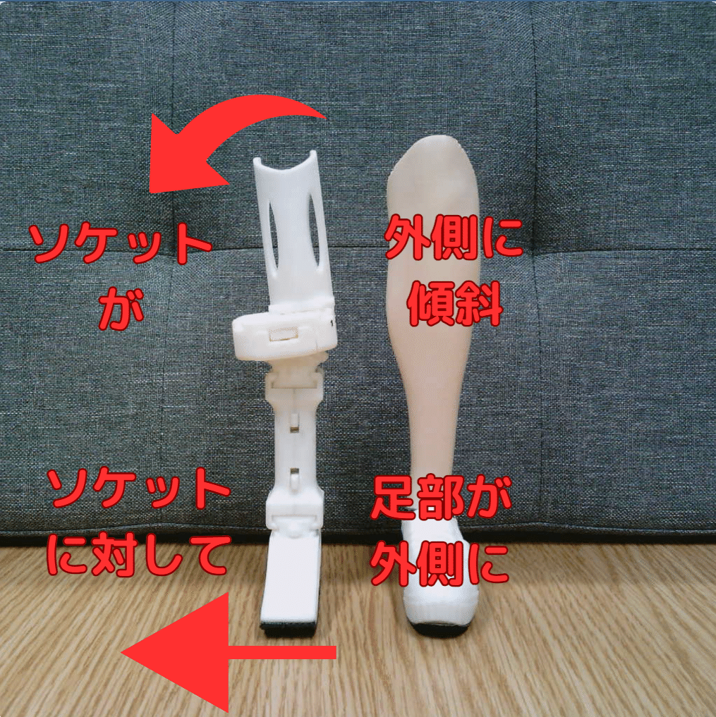 下腿義足：内側方向の不安定感3｜GAIT ASSIST