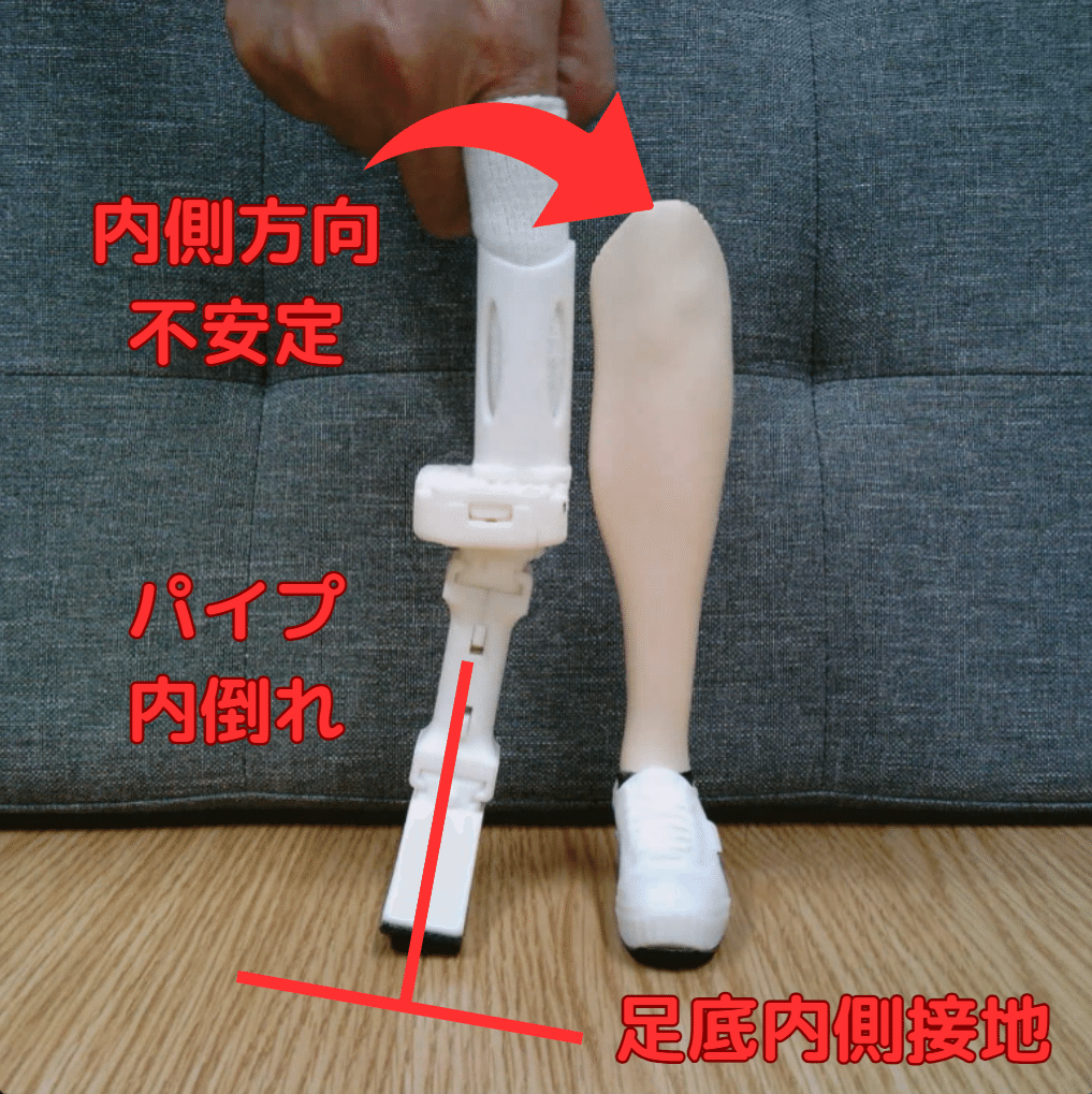 下腿義足：内側方向の不安定感3｜GAIT ASSIST
