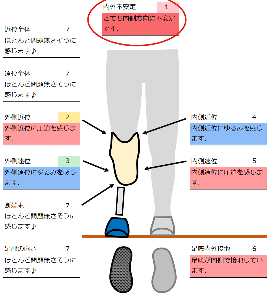 下腿義足：内側方向の不安定感3｜GAIT ASSIST