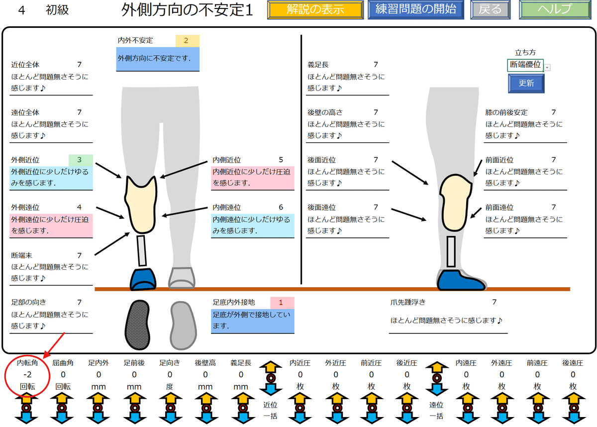 下腿義足：外側方向の不安定感1｜GAIT ASSIST