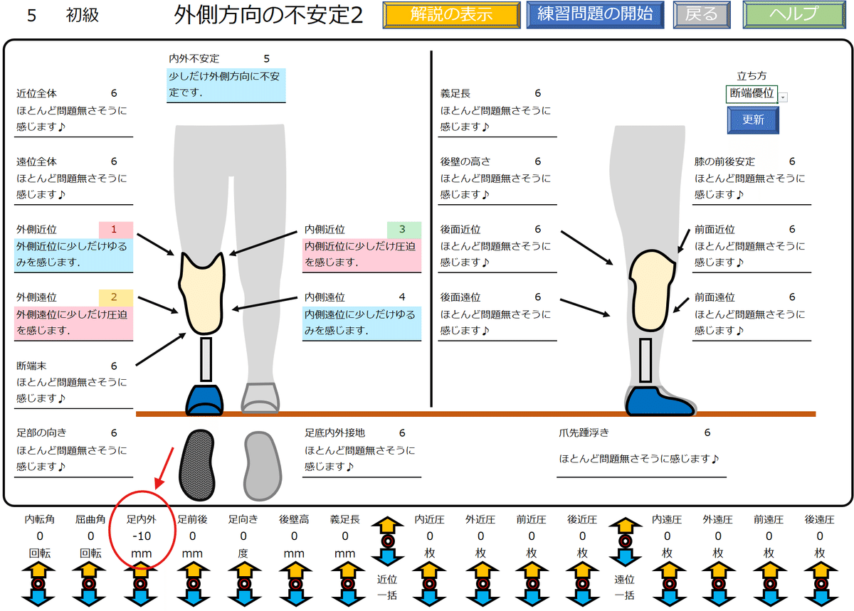 下腿義足：外側方向の不安定感2｜GAIT ASSIST
