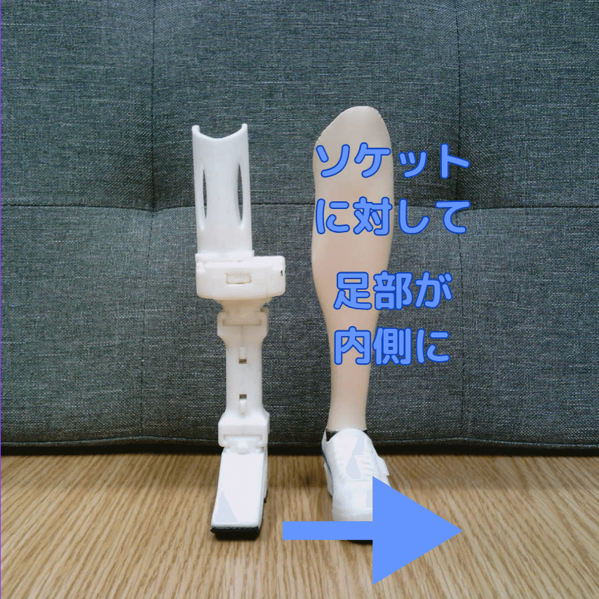 下腿義足：外側方向の不安定感2｜GAIT ASSIST