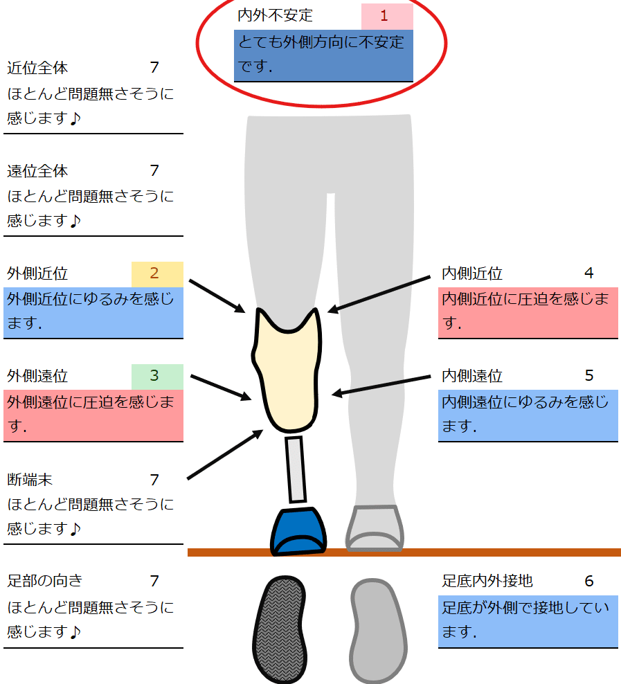 右膝下義足 股義足(片側骨盤切除用) | 株式会社COLABO