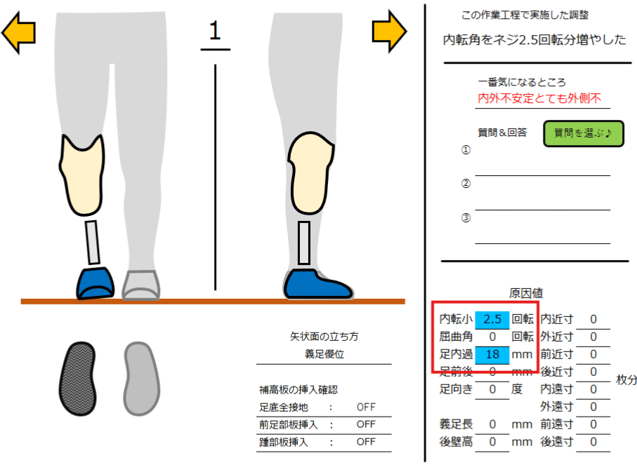 下腿義足：外側方向の不安定感3＜練習問題解説＞｜GAIT ASSIST