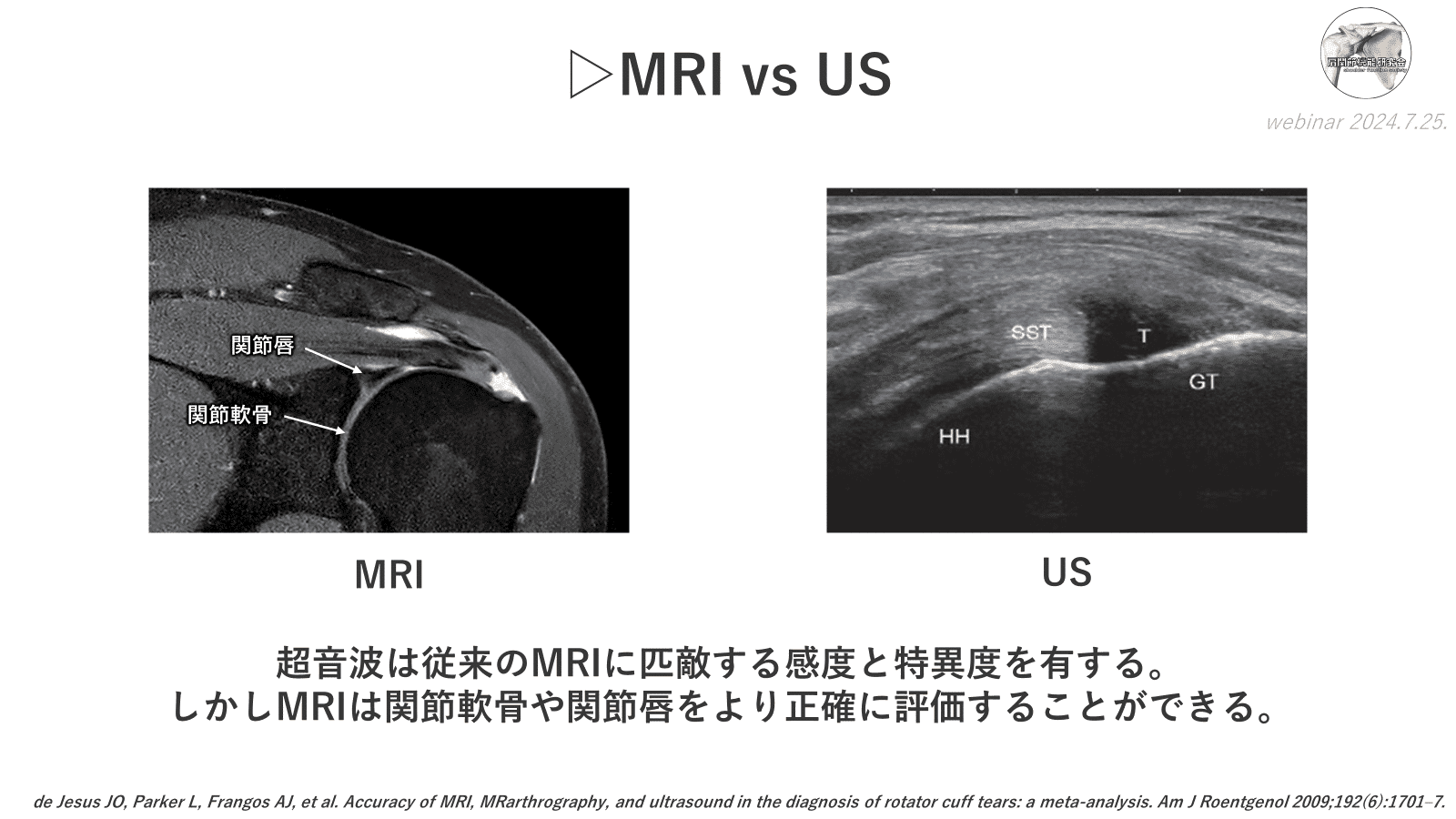 肩関節のMRI−読影ポイントのすべて