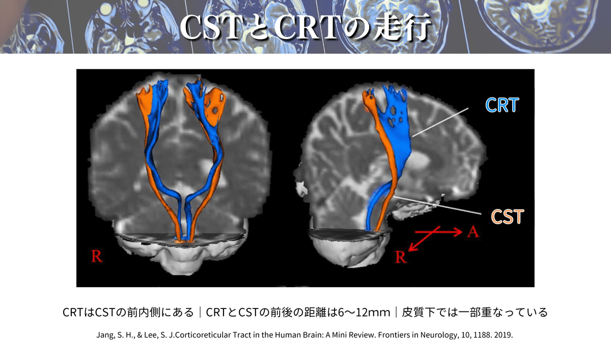 脳脊髄のMRI Amazon.co.jp: 脊椎・脊髄のMRI : Japanese Books
