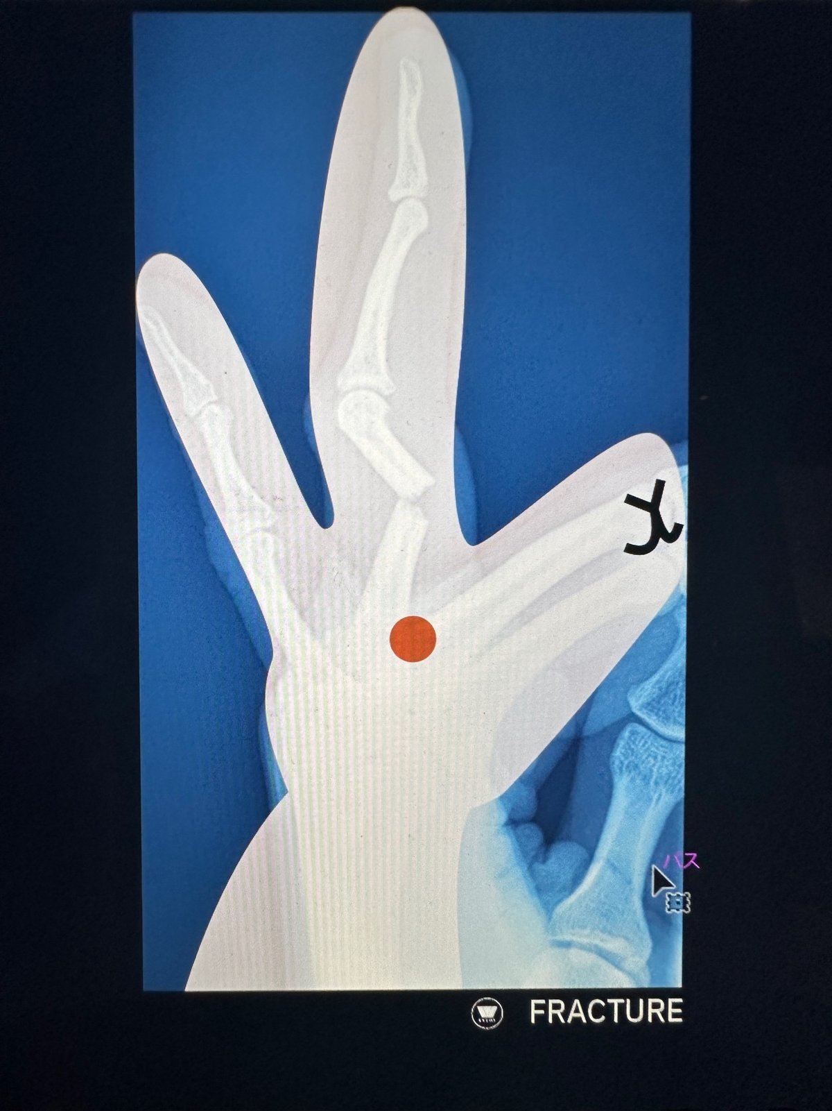 画像
