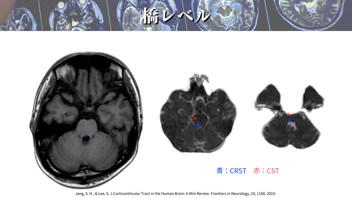 [最終価格] 脳MRI 3冊セット RSNA2023 キヤノンメディカルシステムズ：MRI：高分解能化や撮像