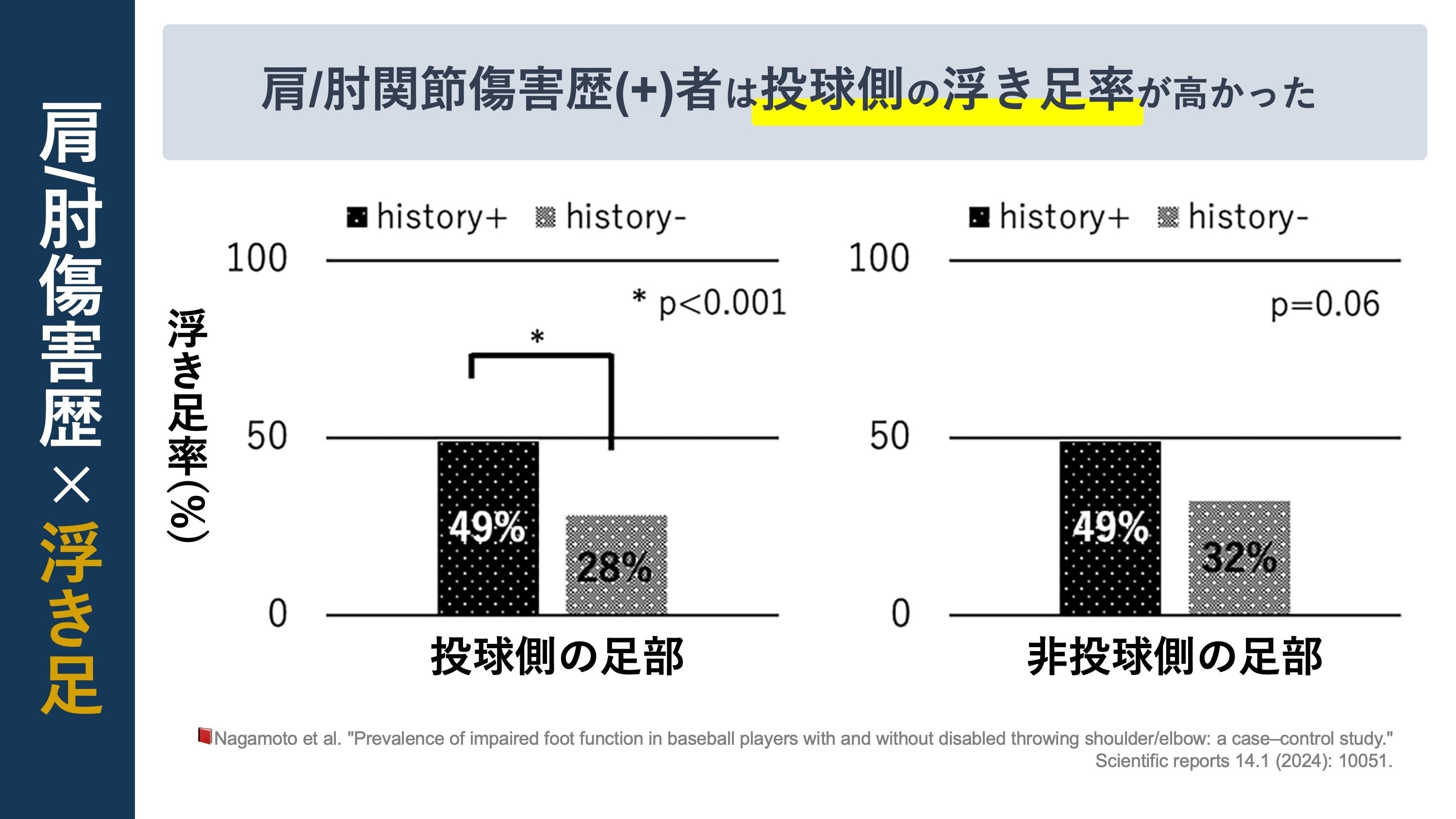 投球障害：肩・肘の障害予防 DVD 投球障害肩に対するアプローチ～急性期から復帰に向けて