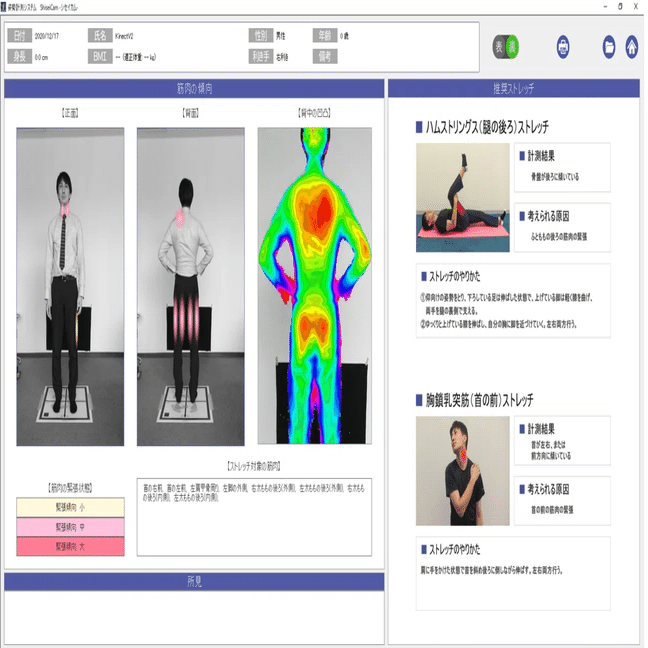 ゆがんでる？社員の姿勢を計測してみた｜キッセイコムテック / 生体