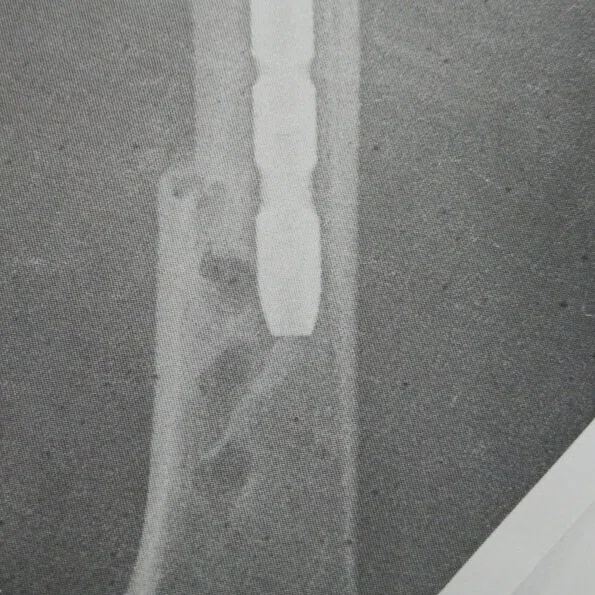 VIOLENCE in yonsei kim & chung orthopedic clinic