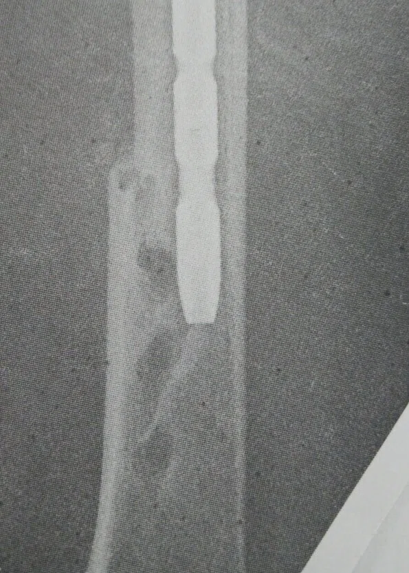 VIOLENCE in yonsei kim & chung orthopedic clinic