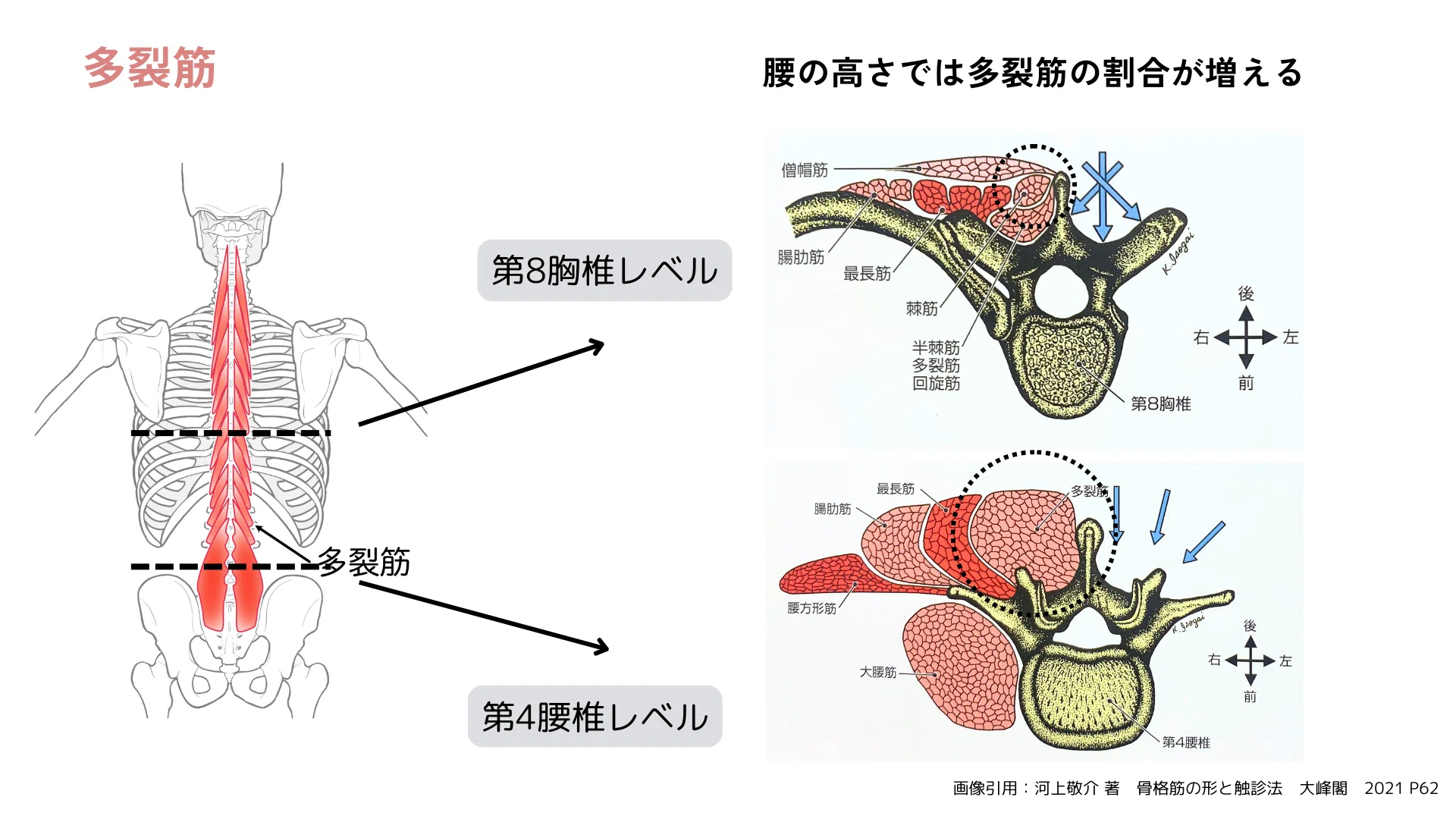 腰痛と多裂筋』インストラクターが知っておくべき3つの評価法と治療