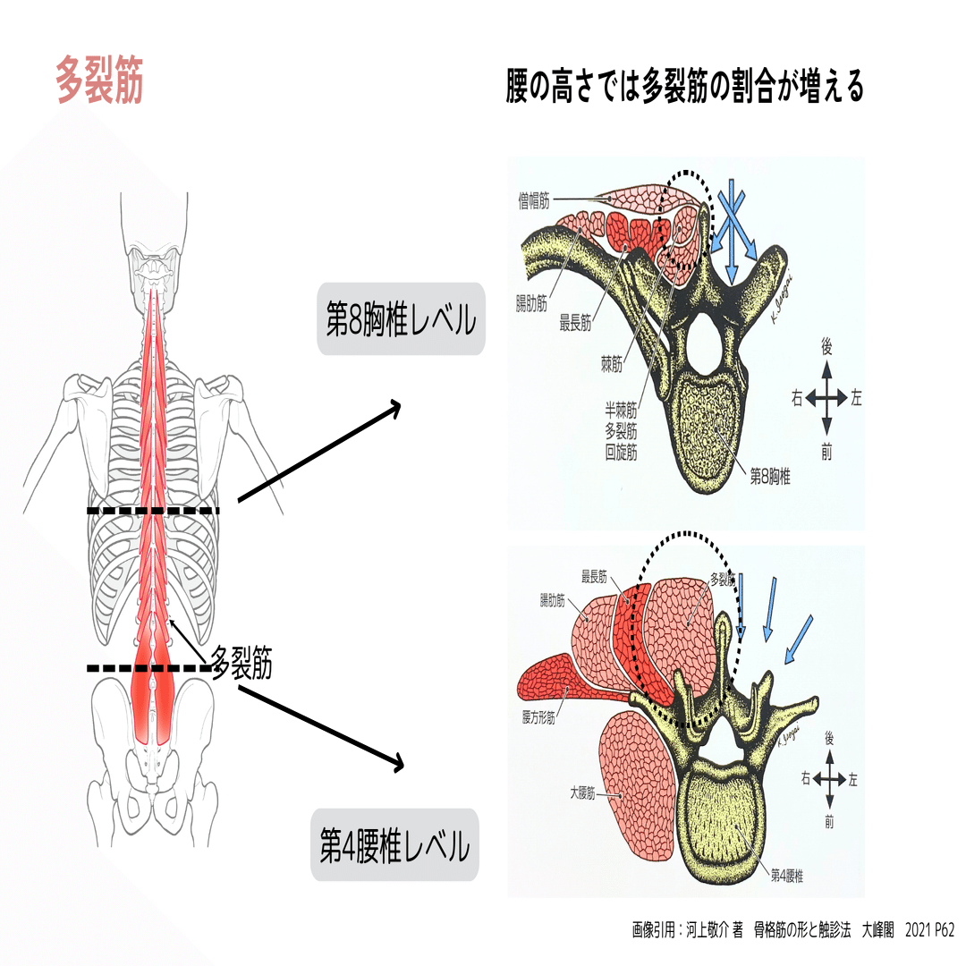 腰痛と多裂筋』インストラクターが知っておくべき3つの評価法と治療