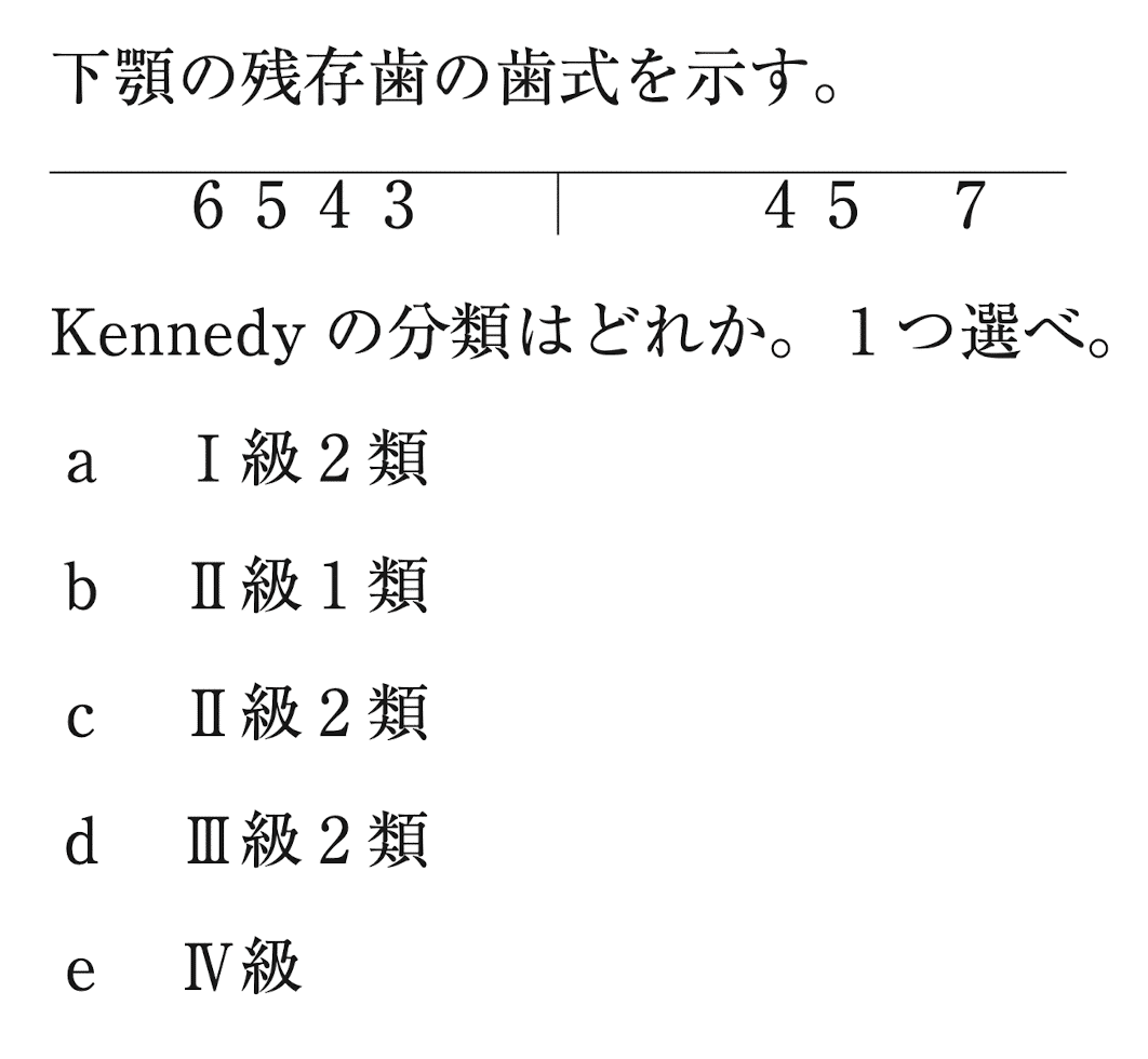 補綴】Applegateの法則とは？｜ころちゃん先生