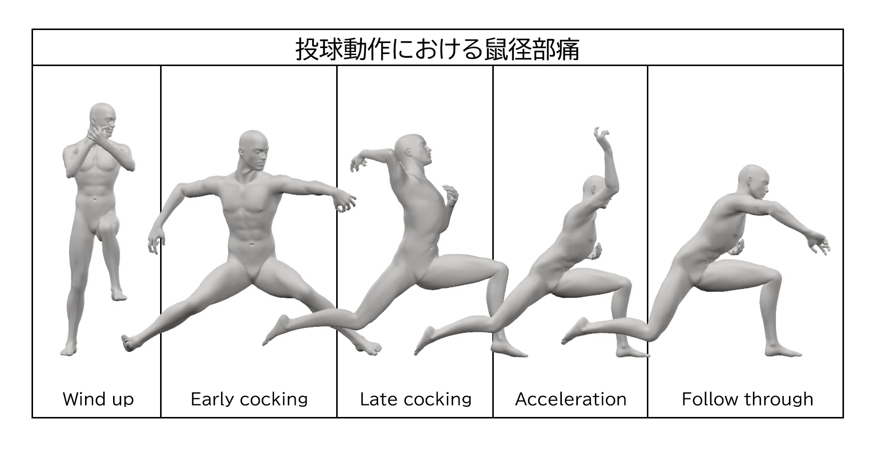投球動作における鼠径部痛の病態とアプローチ -Groin pain syndrome編 投球動作における鼠径部痛の病態とアプローチ -Groin pain syndrome編